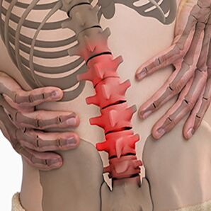 Osteohondroza ledvene hrbtenice