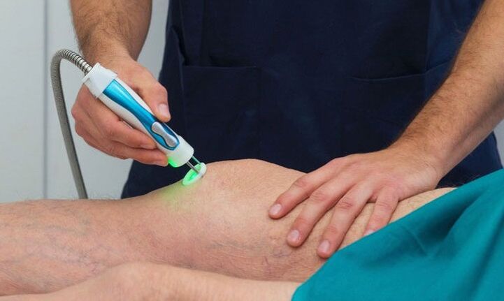 termografija kolenskega sklepa z artrozo